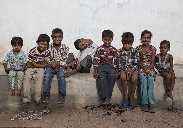 جراحی پسرک هندی با ۱۸۰ درجه وارونگی گردن (تصویر) جراحی پسرک هندی با ۱۸۰ درجه وارونگی گردن (تصویر)
