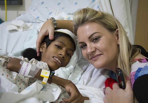 جراحی پسرک هندی با ۱۸۰ درجه وارونگی گردن (تصویر) جراحی پسرک هندی با ۱۸۰ درجه وارونگی گردن (تصویر)