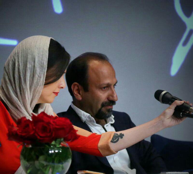 خالکوبی عجیب ترانه علیدوستی (تصویر)