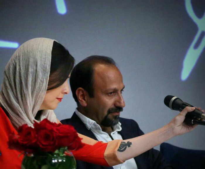 ماجرای خالکوبی ترانه علیدوستی چیست؟ (تصاویر)