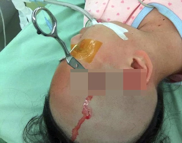 پدر بی‌رحم قیچی را در سر دختر 10 ساله‌اش فرو کرد (تصاویر)
