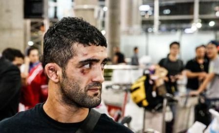 تصویری از صورت زخمی کشتی گیر ایران تصویری از صورت زخمی کشتی گیر ایران