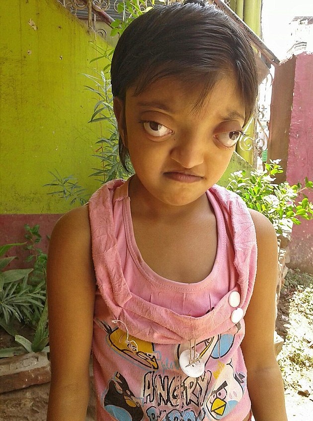 دختری که از چشمان خود می ترسد (تصاویر)