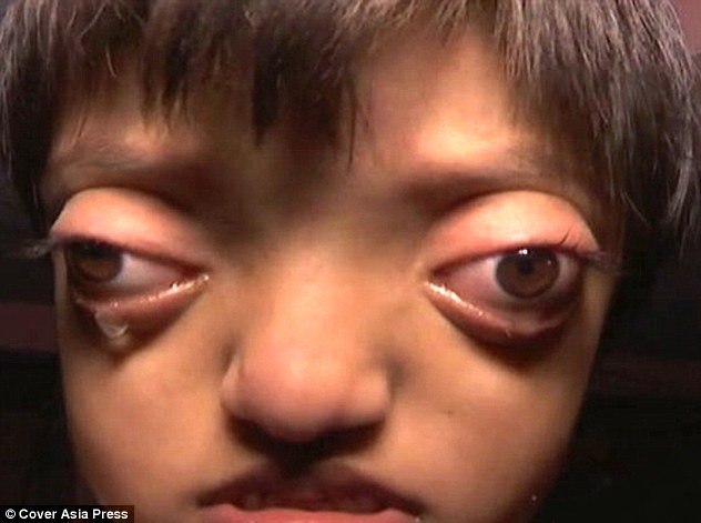 دختری که از چشمان خود می ترسد (تصاویر)