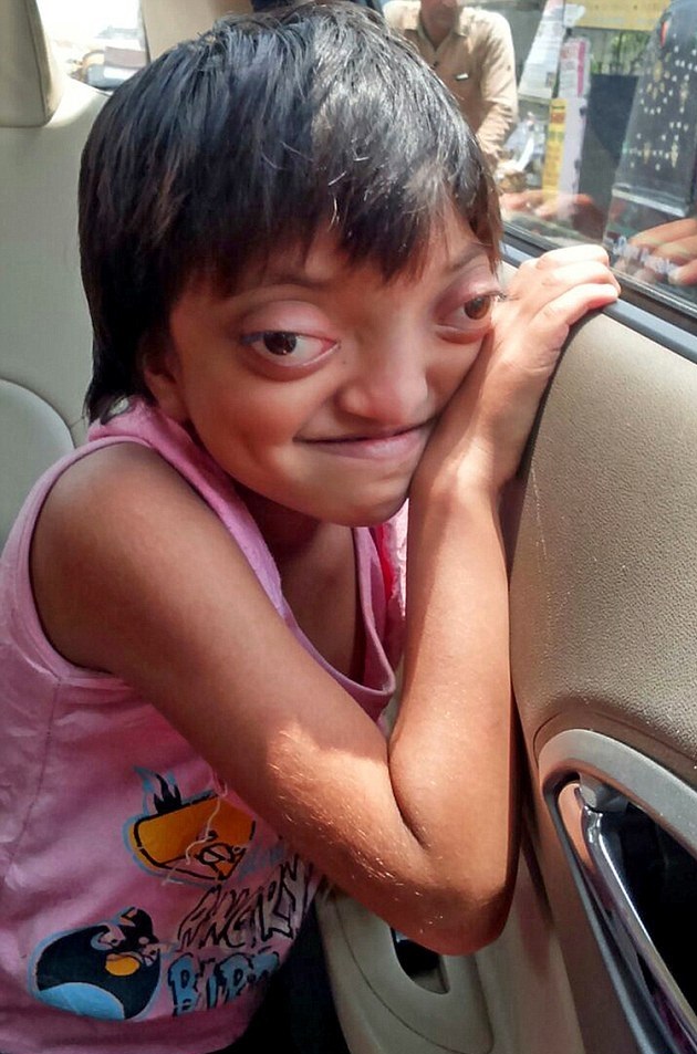 دختری که از چشمان خود می ترسد (تصاویر)