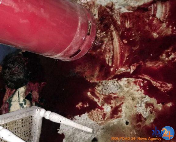 تصاویر دلخراش از حمام خون داعش در بنگلادش (16+)