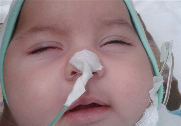 نوزاد 5 ماهه را دریابید/ زندگی نباتی امیر عباس اتفاق یا قصور پزشکی(تصویر)