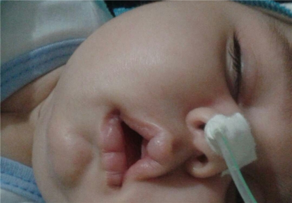 نوزاد 5 ماهه را دریابید/ زندگی نباتی امیر عباس اتفاق یا قصور پزشکی(تصویر)