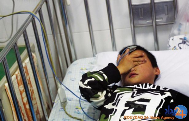 پزشکان 12 میخ را از شکم یک پسربچه بیرون آوردند (تصاویر)