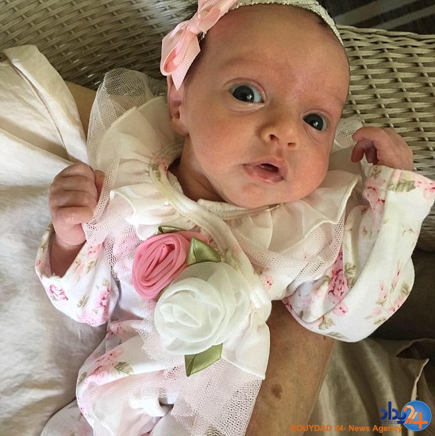 نوزادی که دو بار به دنیا آمد (تصاویر)