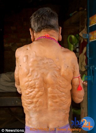 پسر نفرین شده هند (تصاویر)