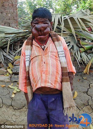 پسر نفرین شده هند (تصاویر)