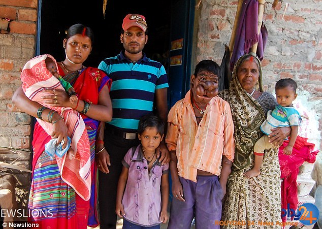 پسر نفرین شده هند (تصاویر)