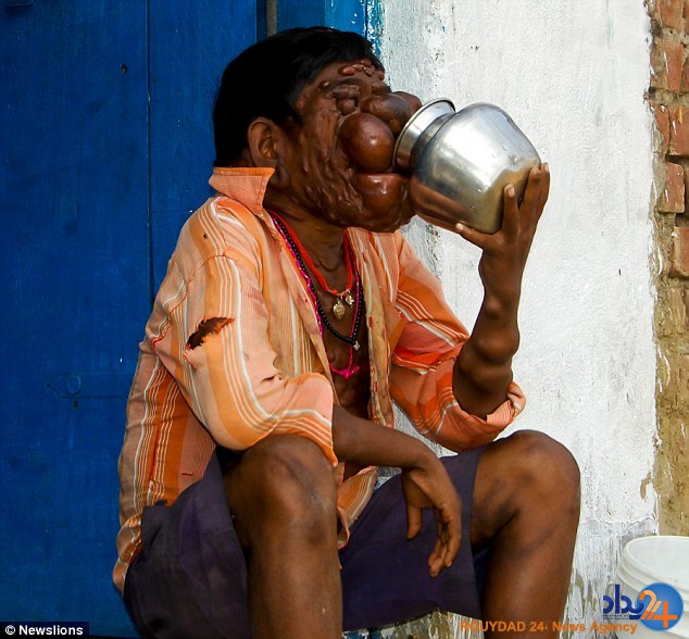 پسر نفرین شده هند (تصاویر)