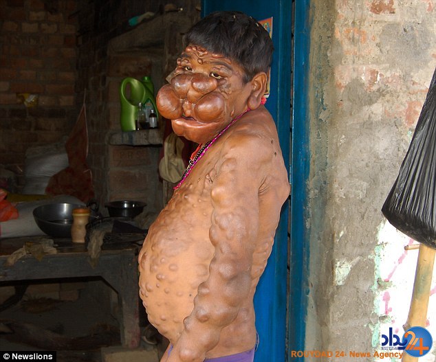 پسر نفرین شده هند (تصاویر)