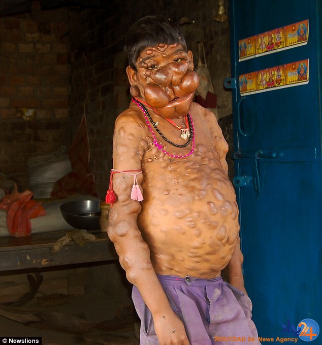 پسر نفرین شده هند (تصاویر)