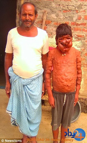 پسر نفرین شده هند (تصاویر)