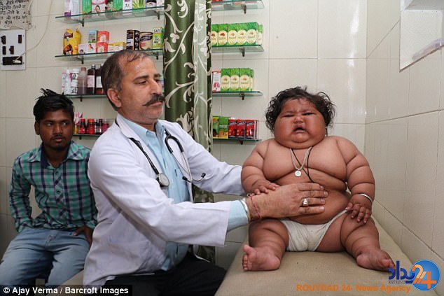 دختر 8 ماهه با 12 کیلو وزن پزشکان را گیج کرده است (تصاویر)