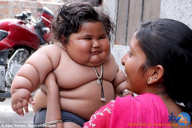 دختر 8 ماهه با 12 کیلو وزن پزشکان را گیج کرده است (تصاویر)