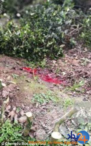 مرگ زنی که پاهایش توسط شوهر اره شد(تصاویر) مرگ زنی که پاهایش توسط شوهر اره شد(تصاویر)