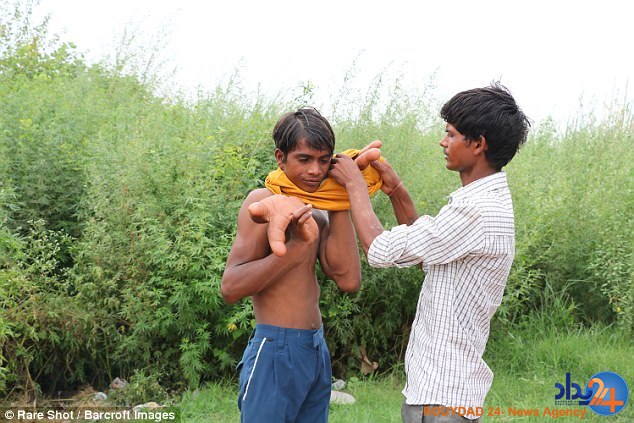 دست‌های عجیب پسر هندی (فیلم و تصاویر)