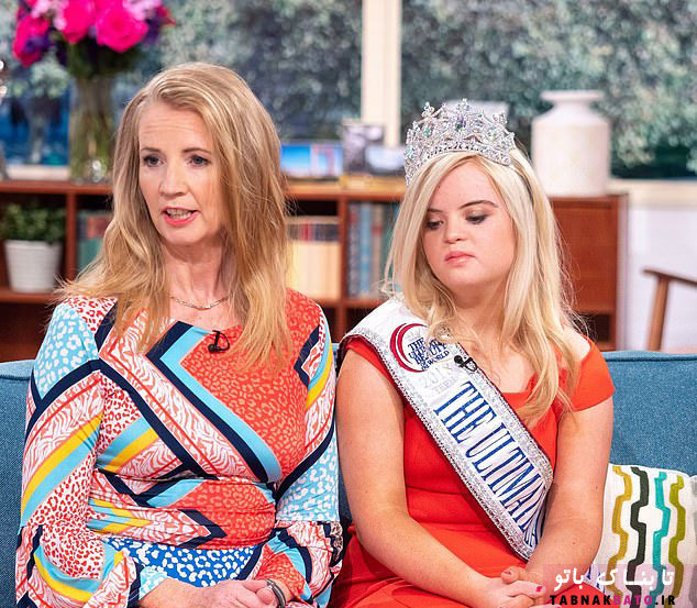 درخشش دختر مبتلا به سندروم داون در دنیای مد و زیبایی +تصاویر