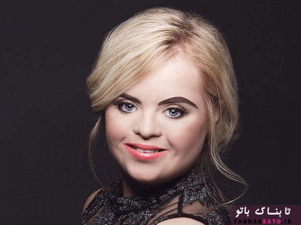 درخشش دختر مبتلا به سندروم داون در دنیای مد و زیبایی +تصاویر