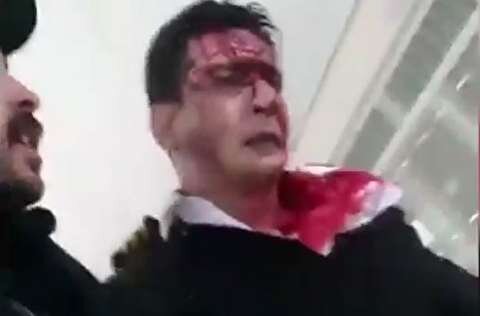 همسر بازمانده سانحه بوئینگ: همسرم هوز در شوک شدید روحی است