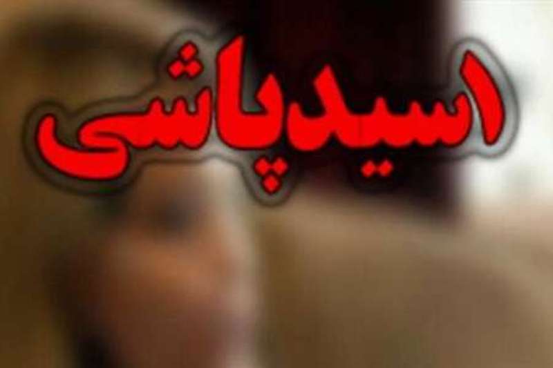 حبس و دیه مجازات عروس اسید پاش