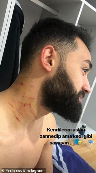 تیغ کشی در ترکیه؛ وسط زمین بین بازیکنان! +عکس