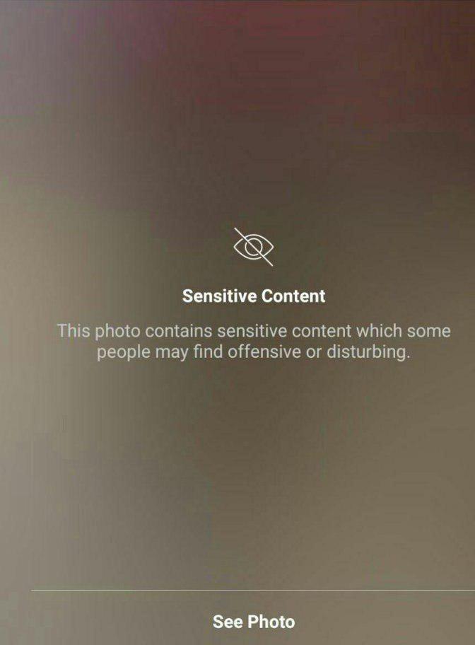 عکس زانوی زخمی ترابی در اینستاگرام فیلتر شد