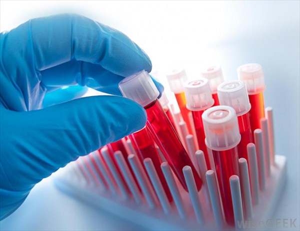 واردات کیت آزمایشگاهی از طریق کولبران!