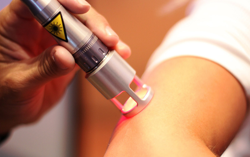 واکنش انجمن پزشکان عمومی به «ممنوعیت لیزردرمانی توسط پزشکان عمومی» واکنش انجمن پزشکان عمومی به «ممنوعیت لیزردرمانی توسط پزشکان عمومی»