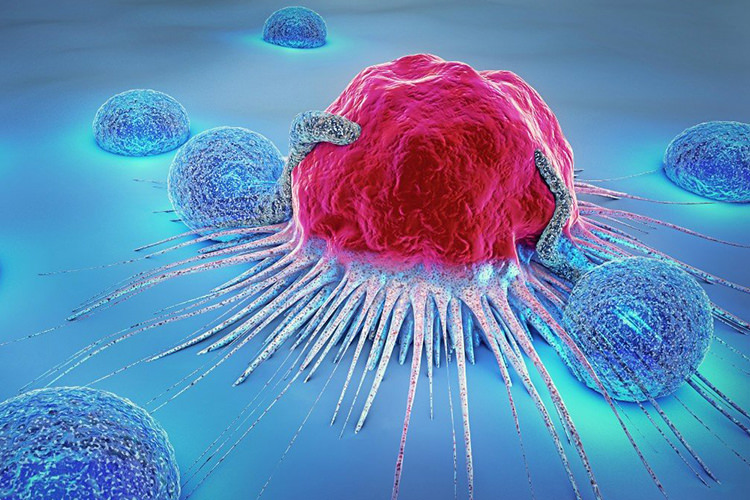 تشخیص دقیق‌ و سریع‌ سرطان با الگوریتم هوش مصنوعی متن باز بایدو