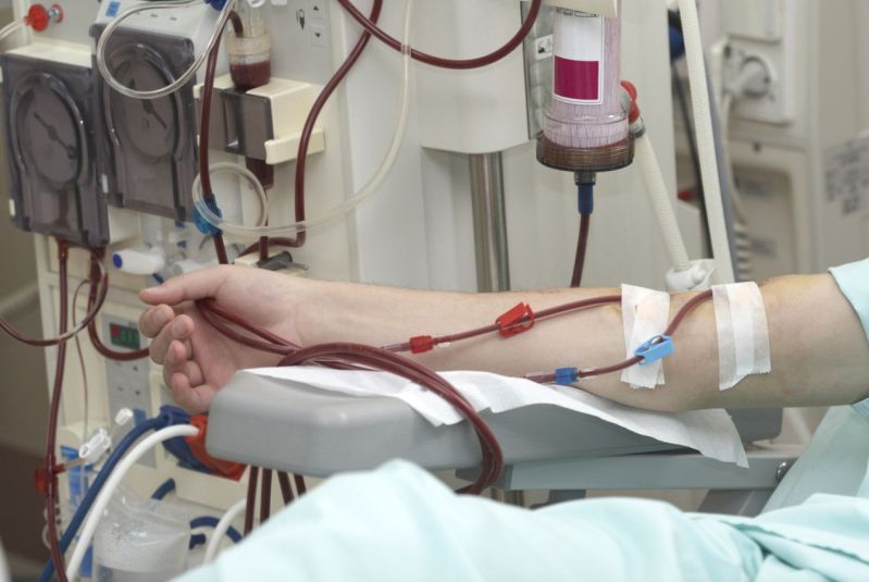 داروی بیماران پیوند کلیه رایگان شد