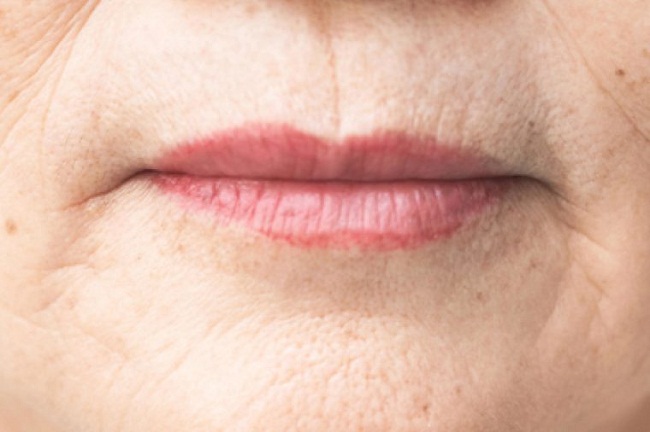 موجودات خطرناکی که در بدن انسان‌ها زندگی می‌کنند!