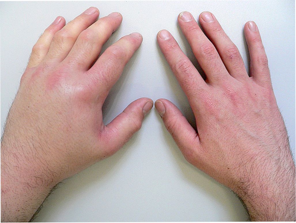 موجودات خطرناکی که در بدن انسان‌ها زندگی می‌کنند!