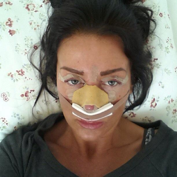 جراحی زیبایی یک زن برای دفن شدن با چهره زیبا هنگام مرگ+ عکس