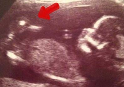 این زن یک اردک را باردار است+ عکس