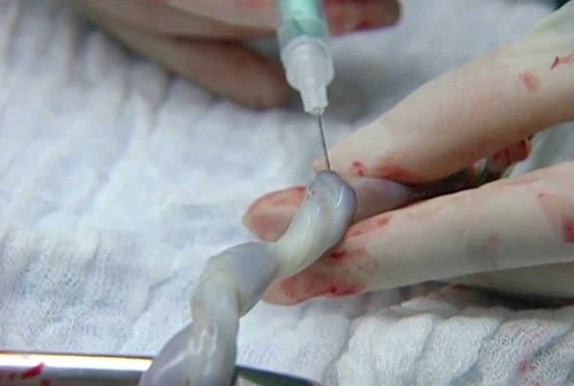 کدام بیمارستان&zwnj;ها، خون بندناف جمع&zwnj;آوری می&zwnj;کنند؟