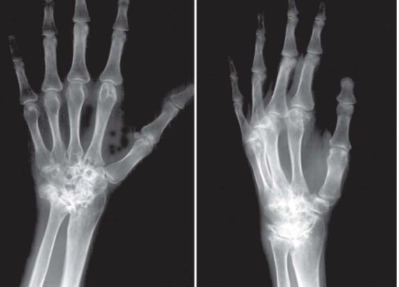 ارائه دستگاهی برای درمان شکستگی&zwnj;های مچ و ساعد/فراهم&zwnj;شدن امکان تصویربرداری در حین عمل جراحی