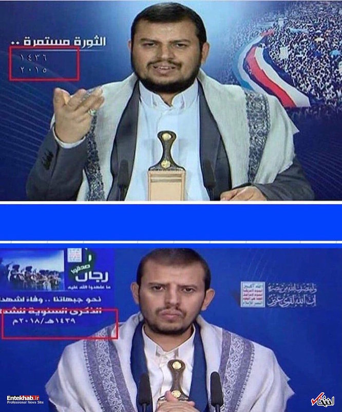 تغییر چهره رهبر یمنی ها به دلیل قحطی +عکس