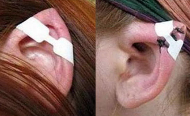 عمل زیبایی نامتعارف کنید، مجازات میشوید عمل زیبایی نامتعارف کنید، مجازات میشوید