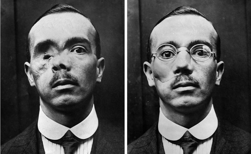 انتشار آمار‌های بی‌سابقه درباره جنگ جهانی اول