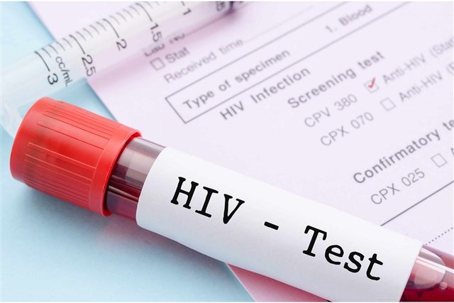 پاداش وزارت بهداشت برای شناسایی موارد جدید ایدز/ توزیع تست‌های خودارزیابی در داروخانه‌ها
