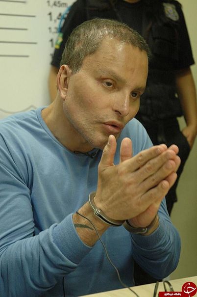 قاچاقی که جراحی پلاستیک کرد تا گیر نیفتد +تصاویر