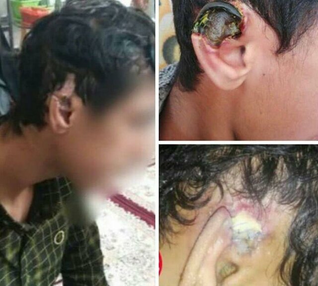 محرومیت مادام العمر عاملان شکستن گوش کشتی‌گیران نوجوان