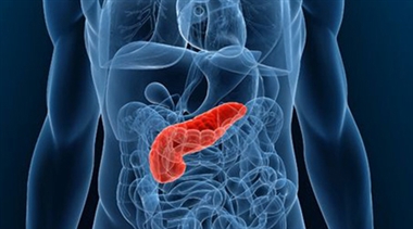 علائم سرطان لوزالمعده که باید جدی بگیرید