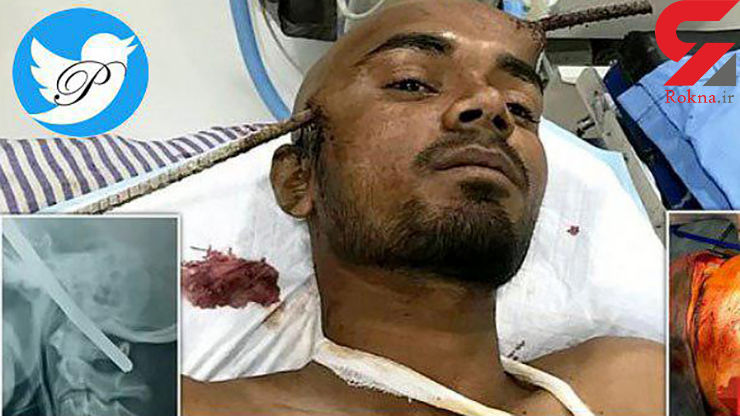 زنده ماندن جوان بعد از فرورفتن میلگرد در سرش +عکس دلخراش زنده ماندن جوان بعد از فرورفتن میلگرد در سرش +عکس دلخراش