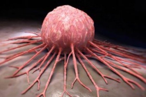 جعبه سیاه تومورهای سرطانی کشف شد جعبه سیاه تومورهای سرطانی کشف شد